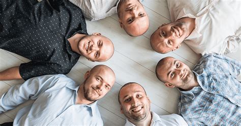 Kaalheid Bij Mannen: Oorzaken En Oplossingen